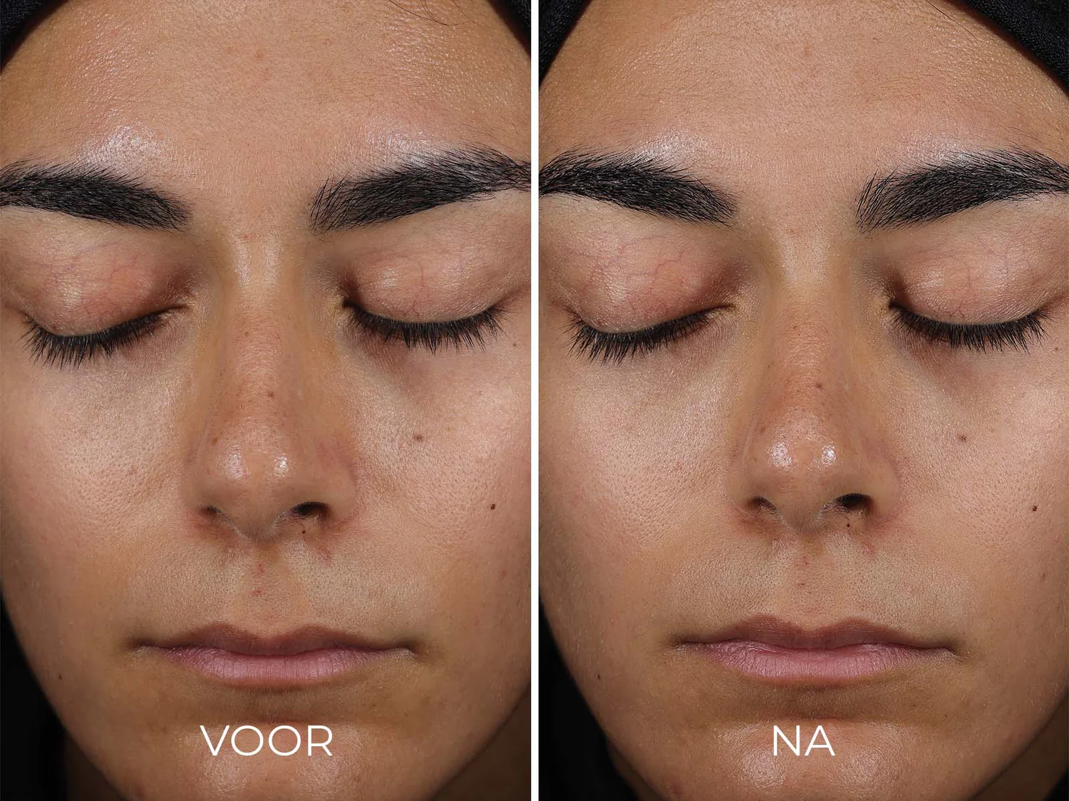 Travel Size DAILY PREVENTION - Sheer Matte Moisturizer SPF 30 - Afbeelding 3