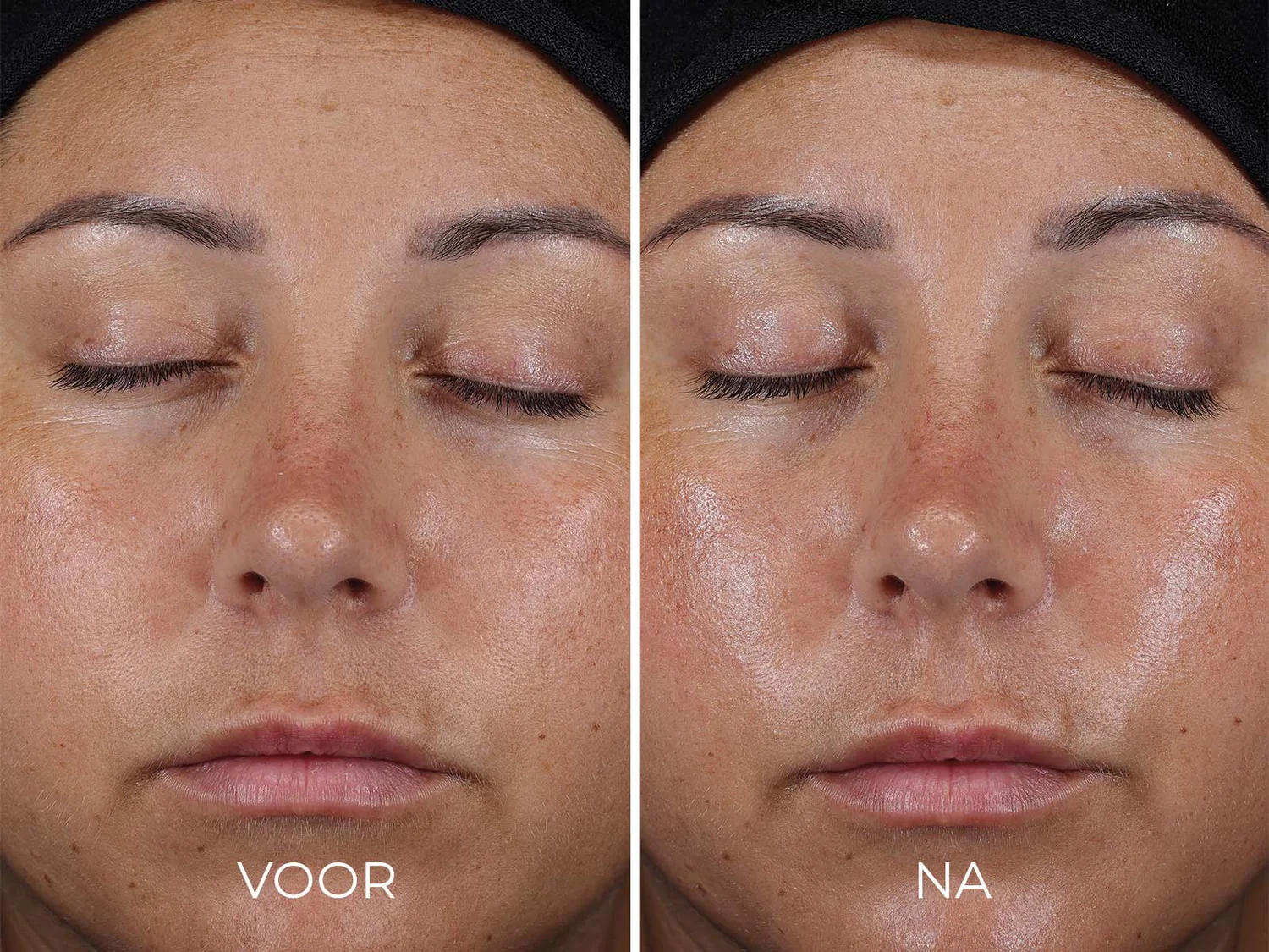 Travel Size DAILY PREVENTION - Ultra Defense Moisturizer SPF 50 - Afbeelding 3