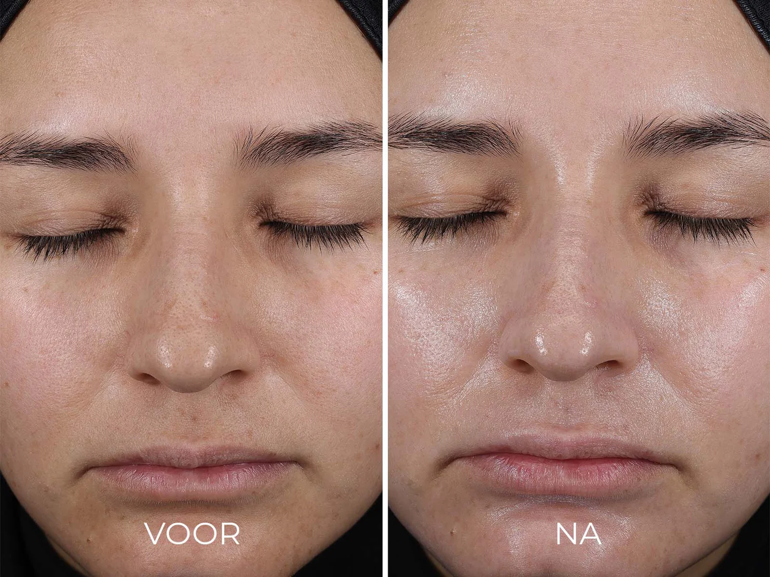 DAILY PREVENTION - Pure Mineral Hydrating Moisturizer SPF 30 - Afbeelding 3